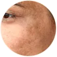 Spot Correction Routine