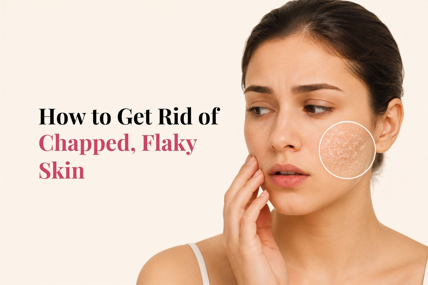 How to Get Rid of Chapped, Flaky Skin