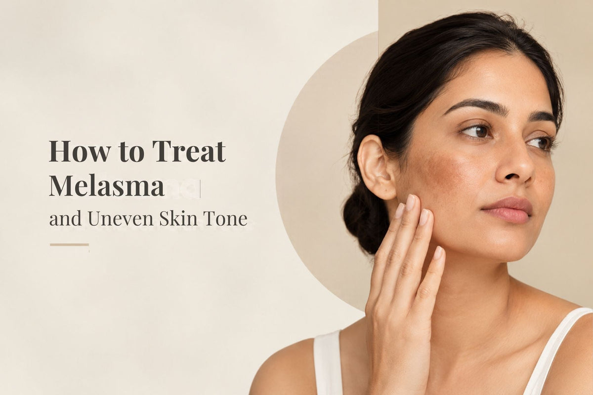 How to Treat Melasma and Uneven Skin Tone