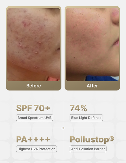 SPF 70+ Daily Sunscreen