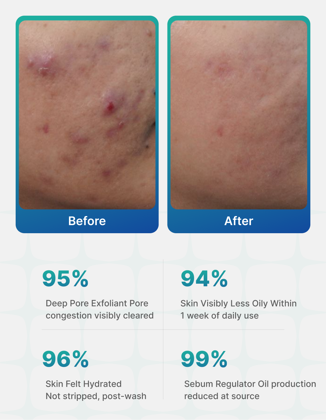 Clarify OC Deep Cleansing Facewash