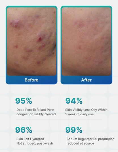 Clarify OC Deep Cleansing Facewash