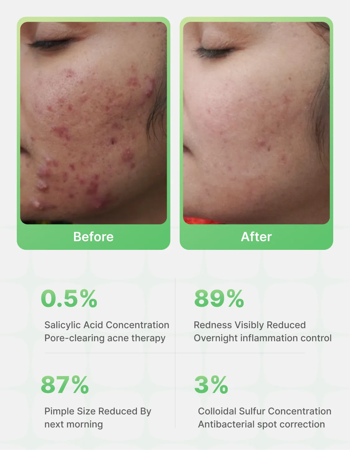 AcneFix™ Instant Pimple Corrector