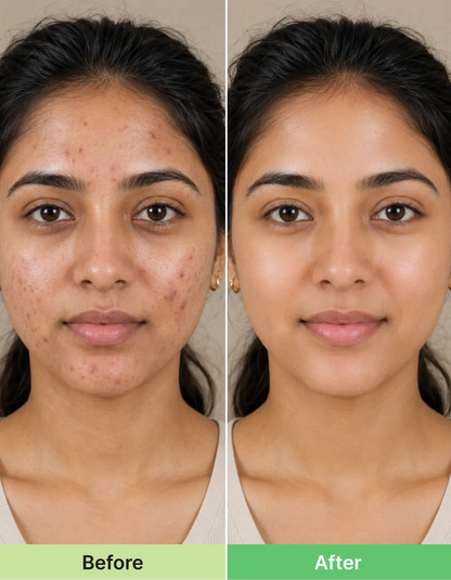 AcneFix™ Instant Pimple Corrector