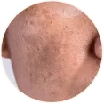 Pigmentation Routine