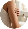 Body Acne Marks Routine