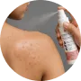 Spray evenly from 6–8 inches away on affected areas.