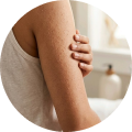 Body Acne Marks Routine