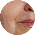 Anti-Ageing
