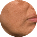 Combination Skin