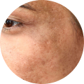 Spot Correction Routine