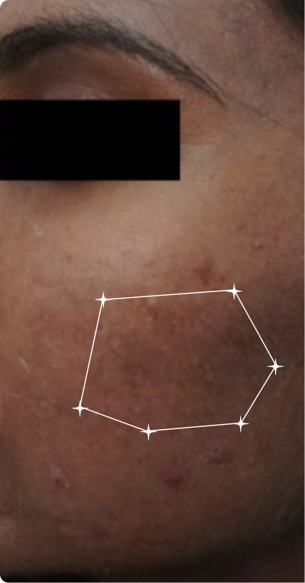 Before — Dull Skin
