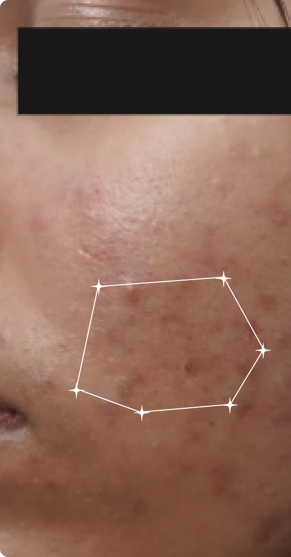 Before — Sensitive Skin