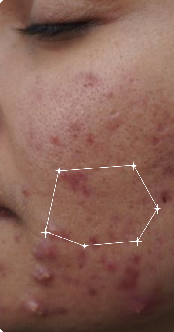 Before — Overnight Results