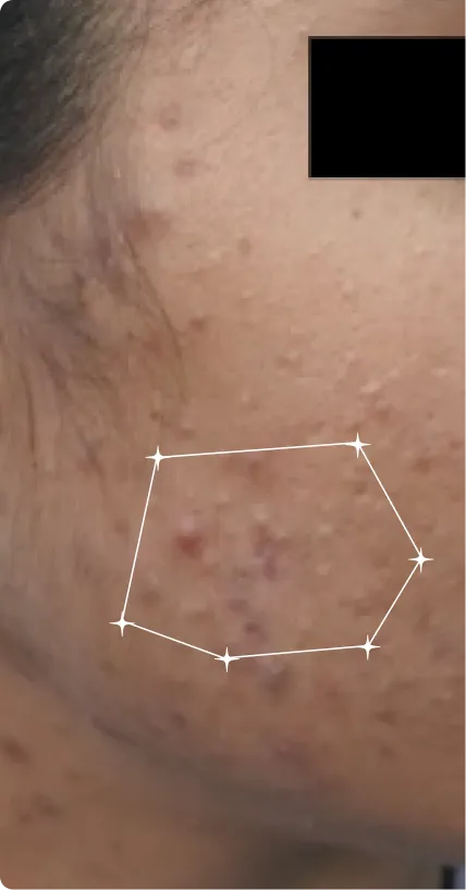 Before — Sensitive-Oily