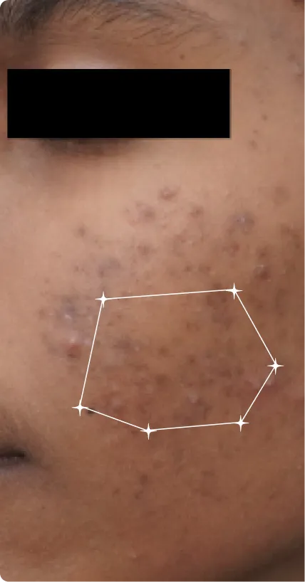 Before — Pigmentation