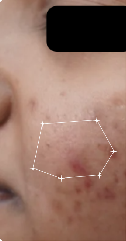 Before — Sensitive-Oily