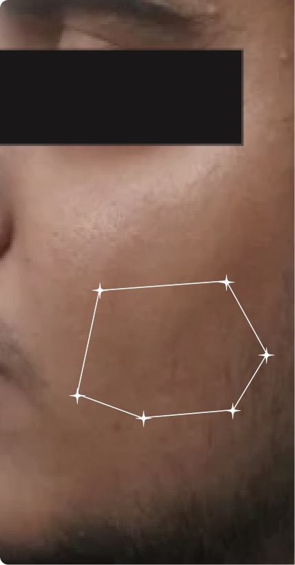 Before — Daily Use