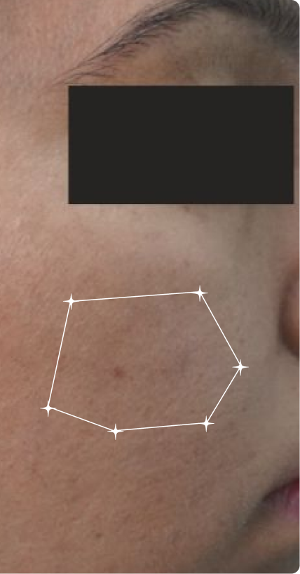 After — Uneven Tone