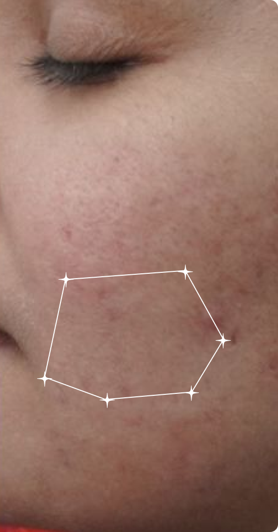 After — Overnight Results