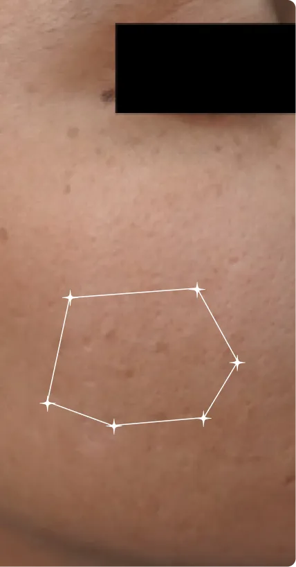 After — Sensitive-Oily