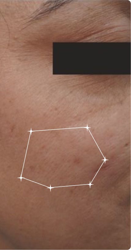 Before — Uneven Tone
